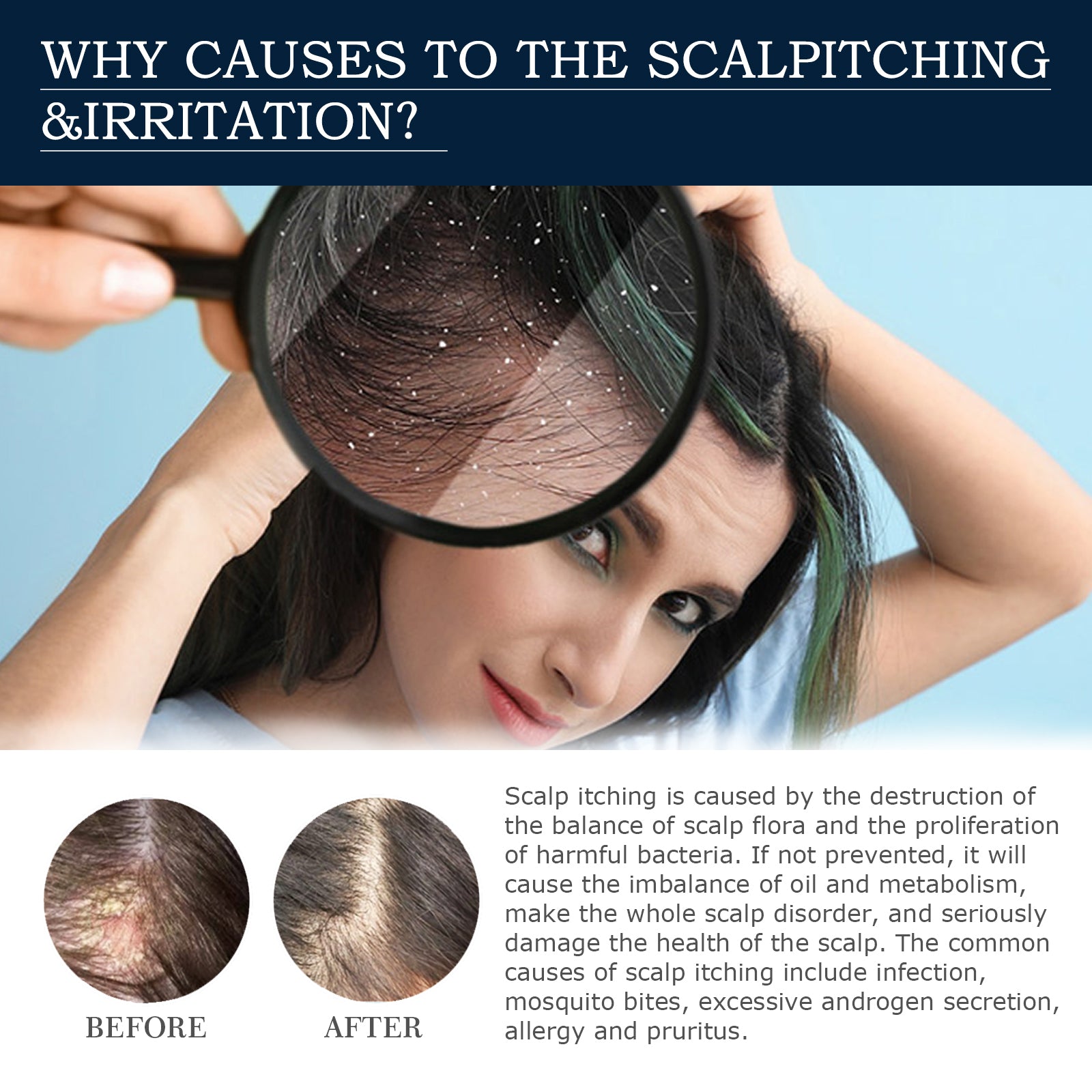 Hair Follicle Strengthening Spray | Anti-Hair Loss Scalp Spray | Hair Growth Treatment Mist | Scalp Revitalizing Hair Tonic | Damaged Hair Repair Spray | Natural Hair Nourishment Spray | Follicle Stimulating Treatment | Hair Regrowth Support Spray | Herbal Scalp Therapy Mist | Daily Use Hair Treatment Spray


