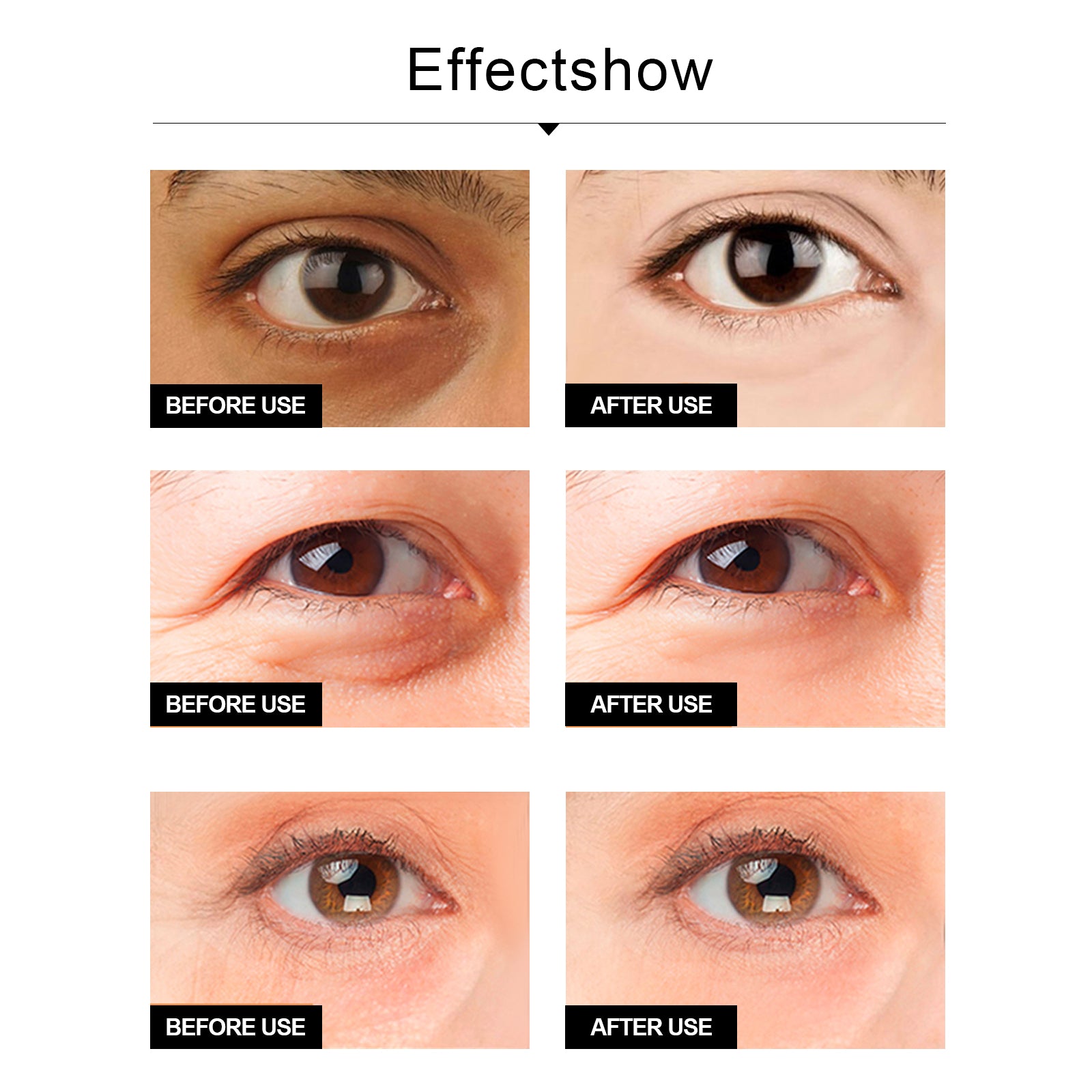 Anti-Wrinkle Snake Eye Cream | Peptide Eye Cream for Puffiness | Under Eye Dark Circle Cream | Snake Extract Firming Cream | Anti-Aging Eye Treatment | Fine Line Eye Moisturizer | Eye Cream with Snake Venom | Wrinkle Smoothing Eye Gel | Collagen Boost Eye Cream | Youthful Eyes Treatment Cream

