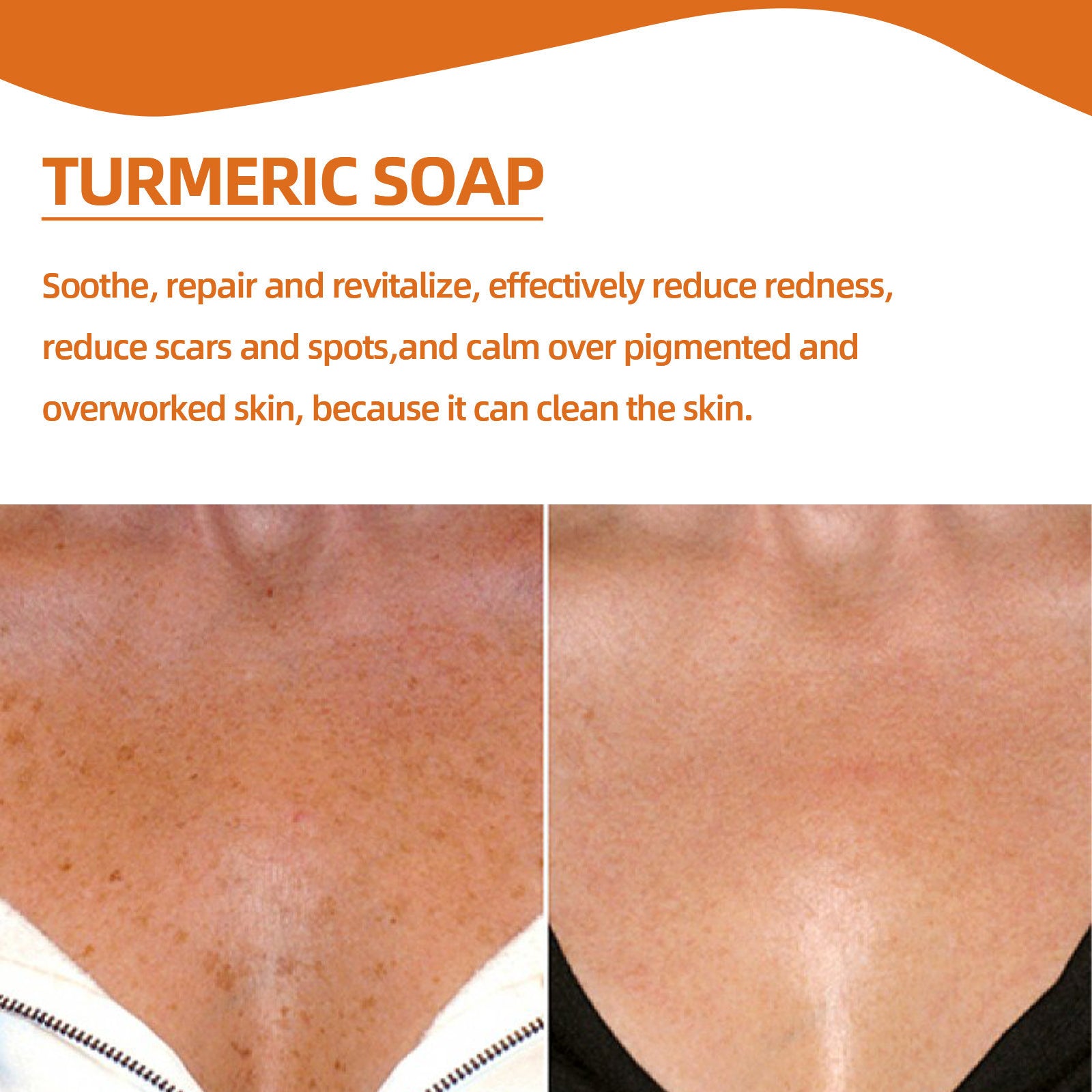 Turmeric Soap, Refreshing Tender Skin Lightening Dark Spot Acne Print Smooth Skin Body Cleansing Soap - Rituel Serein