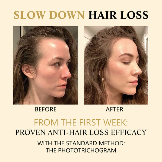 Hair Growth Boosting Essence | Darkening Hair Serum | Strengthening Hair Follicle Treatment | Herbal Hair Growth Essence | Natural Hair Darkening Drops | Thicker Fuller Hair Growth Essence | Anti-Thinning Hair Booster | Hair Pigment Restoring Serum | Healthy Hair Growth Enhancer | Daily Hair Strengthening Essence

