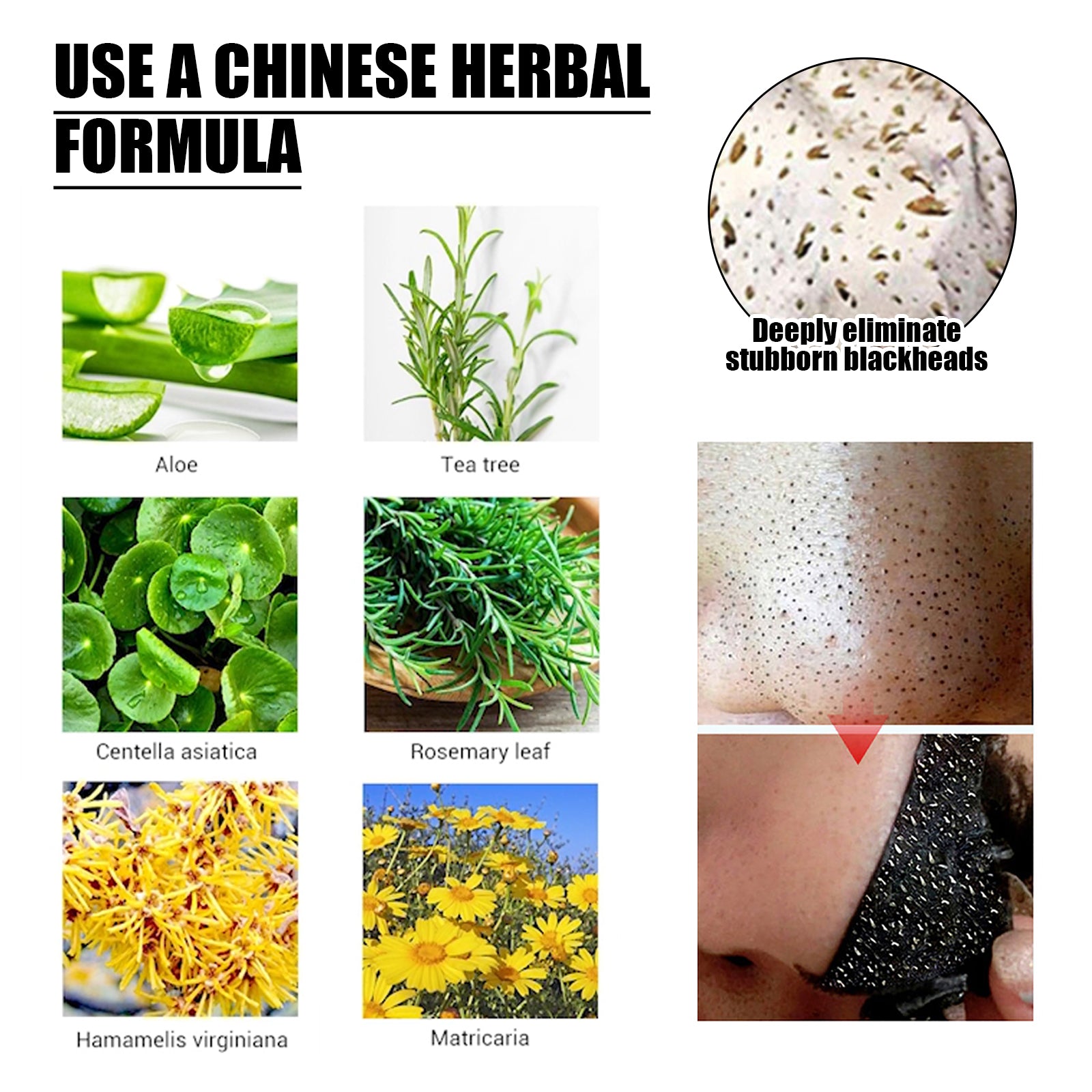 Charcoal Peel-Off Blackhead Mask | Deep Cleansing Facial Mask | Blackhead Remover Mask | Oil Control Peel-Off Treatment | Acne Pore Cleansing Mask | Skin Purifying Blackhead Mask | Peel-Off Face Mask for Oily Skin | Aloe Charcoal Mask | Pore Strip Face Mask | Anti-Acne Peel Mask

