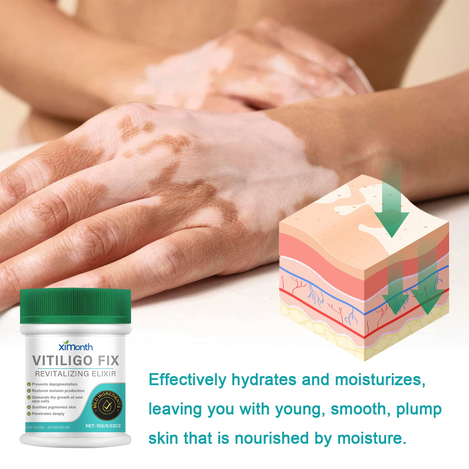 Vitiligo Fix Revitalizing Elixir, Lighten Skin Spots Even Skin Tone Moisturizing Body Care Repair Cream - Rituel Serein