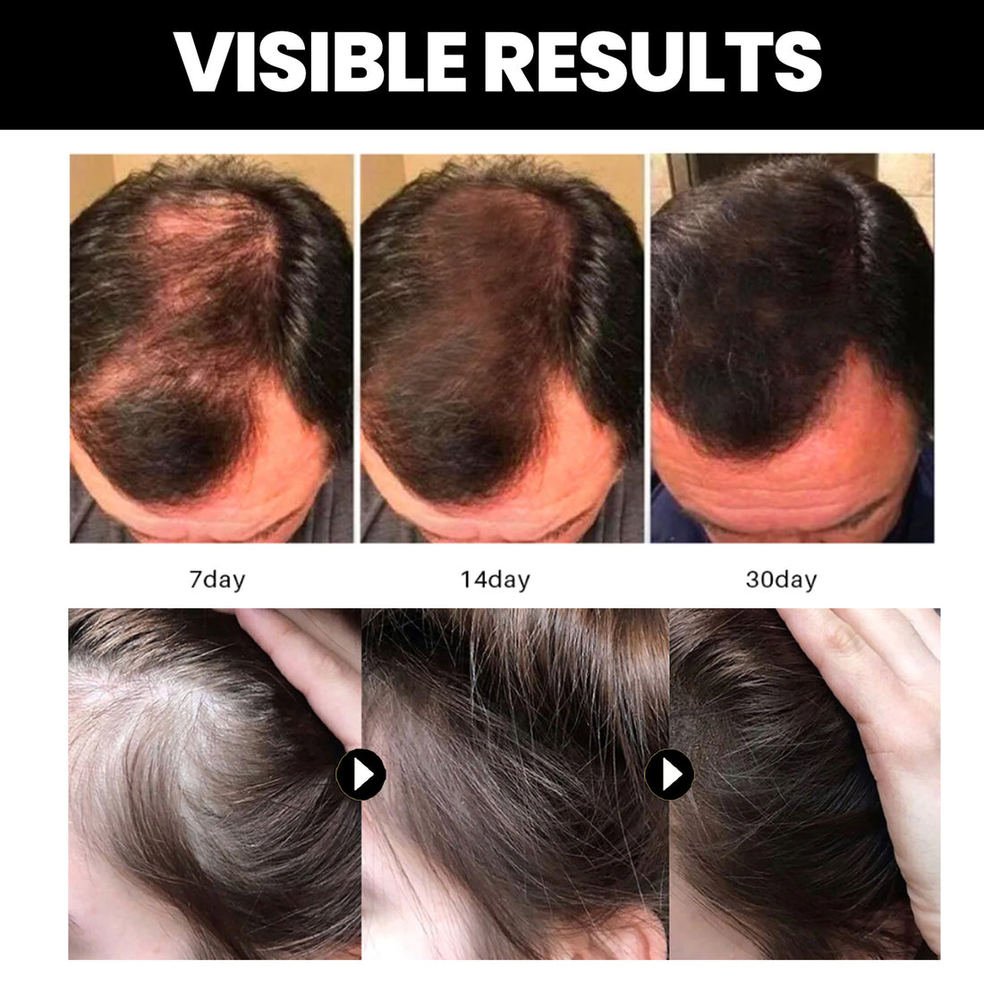 Natural Hair Smoothing Oil | Nourishing Hair Repair Oil | Batana Oil for Hair Growth | Deep Conditioning Hair Oil | Anti-Frizz Hair Treatment Oil | Shine Enhancing Hair Serum | Moisturizing Hair Oil with Batana | Hair Strengthening Natural Oil | Restorative Hair Oil for Damaged Hair | Lightweight Daily Hair Oil