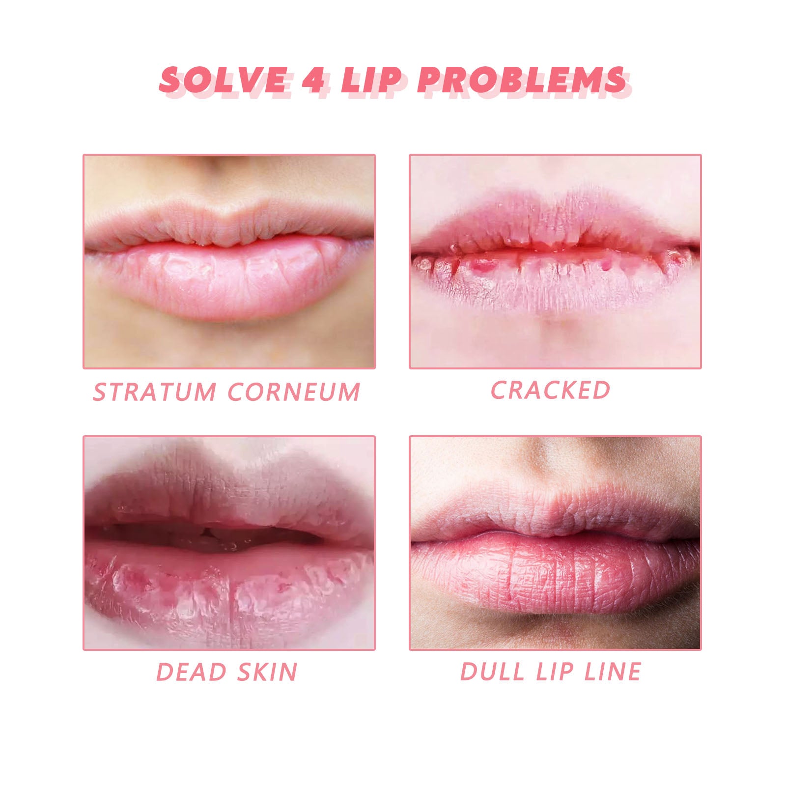 Peach Lip Scrub Moisturizes The Lips, Hydrates The Lips, Lightens The Skin Around The Lips And Improves The Corners Of The Mouth - Rituel Serein