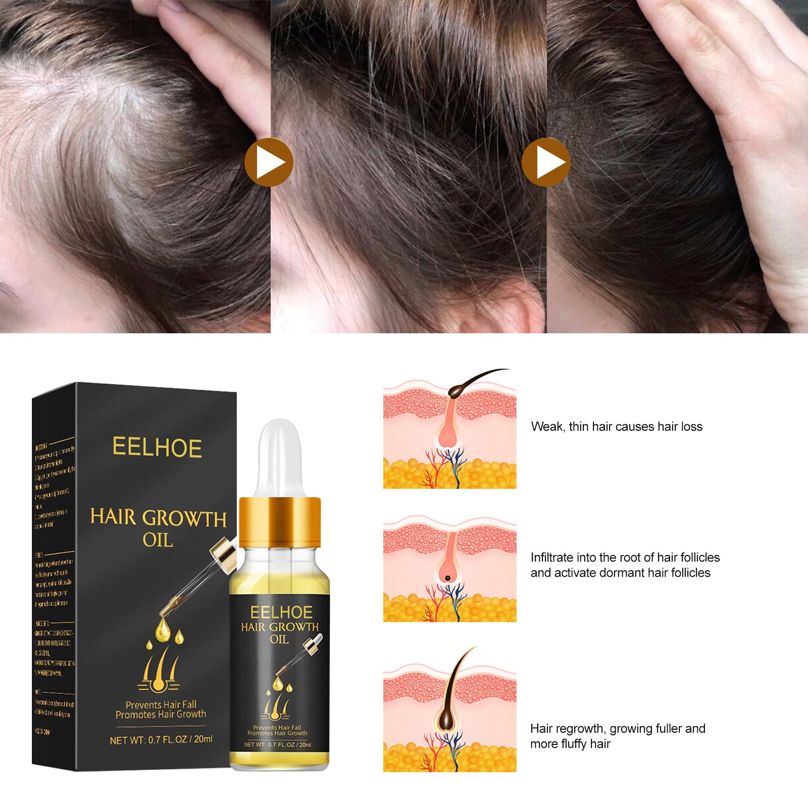 Natural Hair Growth Oil | Moisturizing Hair Strengthening Oil | Essential Oil for Hair Repair | Botanical Hair Growth Oil | Lightweight Hair Nourishing Oil | Daily Hair Care Oil | Organic Hair Thickening Oil | Hair Moisture Boosting Oil | Fast Hair Growth Treatment Oil | Revitalizing Hair Repair Oil
