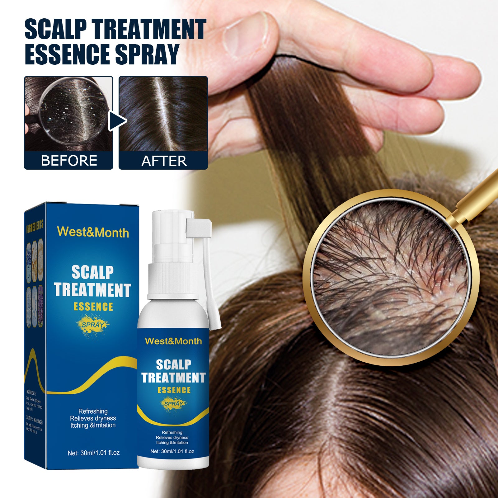 Hair Follicle Strengthening Spray | Anti-Hair Loss Scalp Spray | Hair Growth Treatment Mist | Scalp Revitalizing Hair Tonic | Damaged Hair Repair Spray | Natural Hair Nourishment Spray | Follicle Stimulating Treatment | Hair Regrowth Support Spray | Herbal Scalp Therapy Mist | Daily Use Hair Treatment Spray

